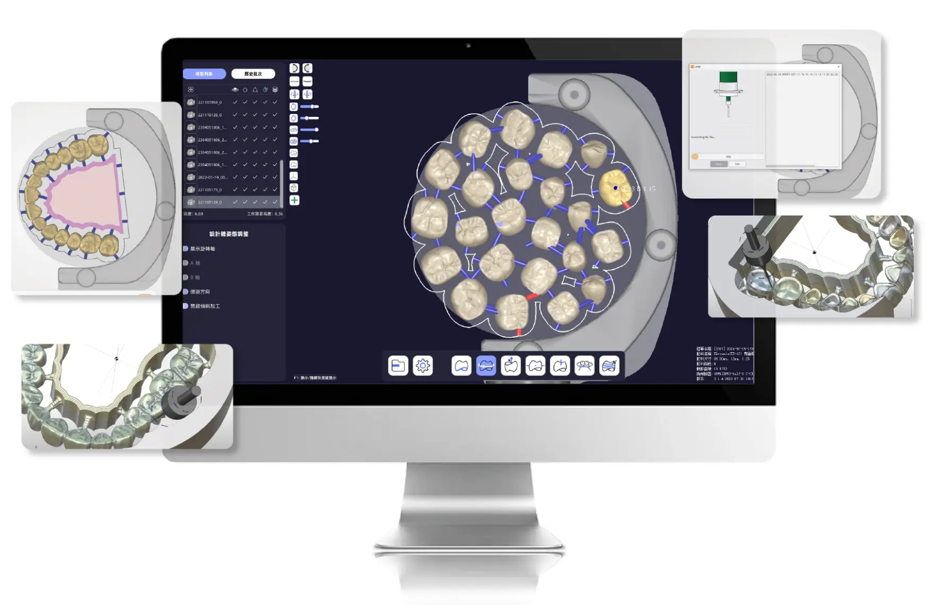 Automatic Tooth Finding